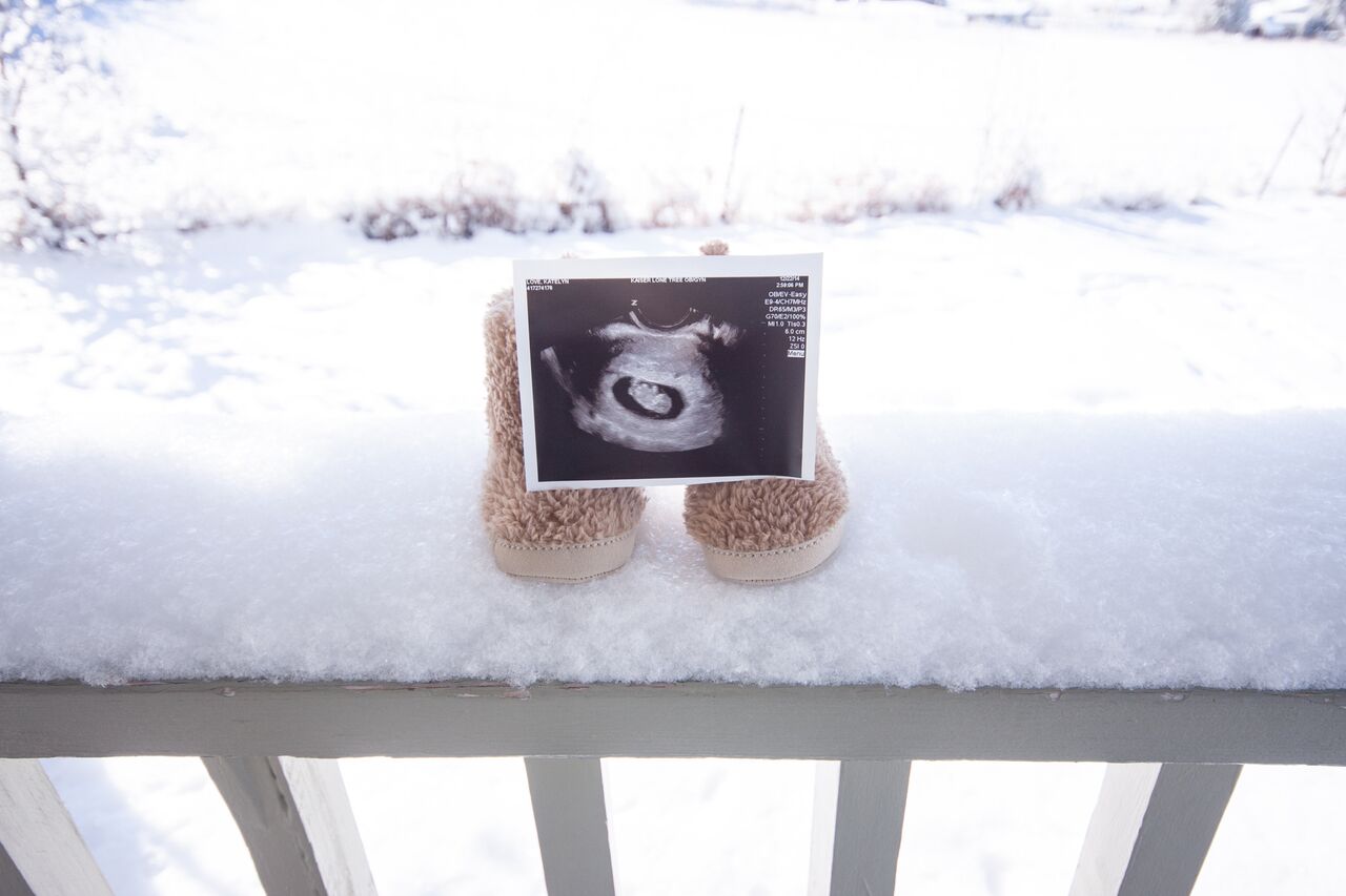 Pregnancy Announcement Ideas featured by popular Denver mom blogger, All Things Lovely